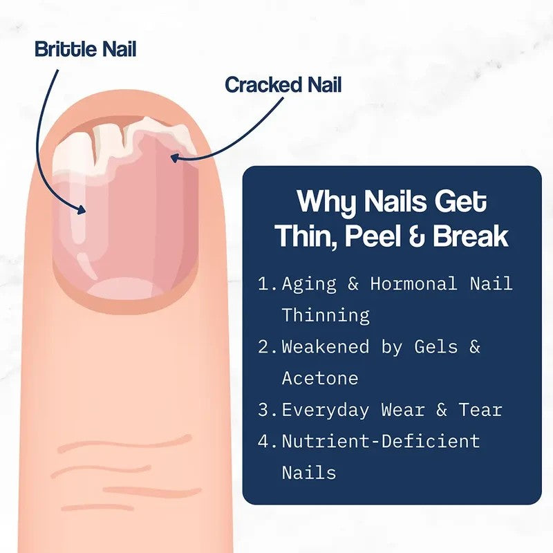 NailGuard Pro By Evolene